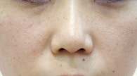 Before1.jpg